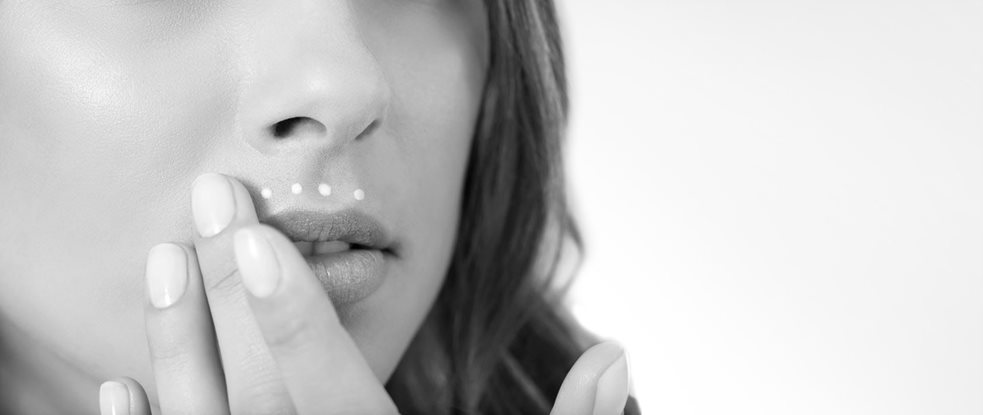 Het gezicht van een vrouw met melasma