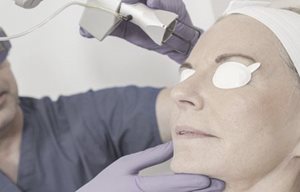 Een vrouw ondergaat een laserbehandeling op haar gezicht.
