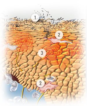 Afbeelding van huid met symptomen van atopische dermatitis.