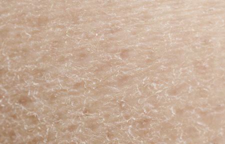 Close-up van een droge huid