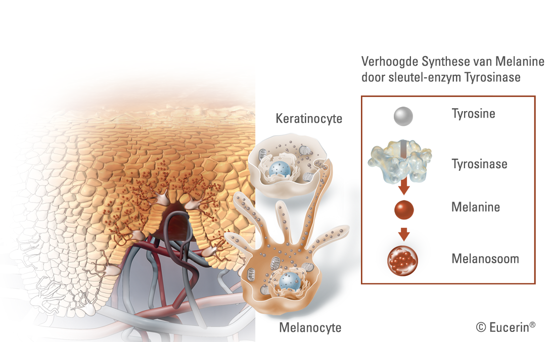 Afbeelding van het verschijnen van huidpigmentatie